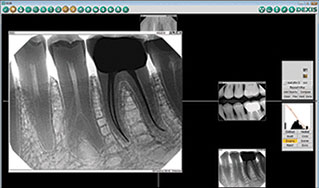 X-Ray Image